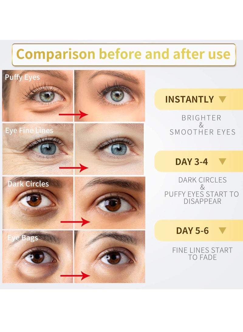 24K نازانو رقع تحت العين - 30 زوجًا - قناع العين الذهبي عيار 24 قيراط - علاج العيون المنتفخة والهالات السوداء، تقلل الانتفاخات تحت العين والتجاعيد الملساء، وسادات العناية ببشرة العين بالكولاجين - Image 3