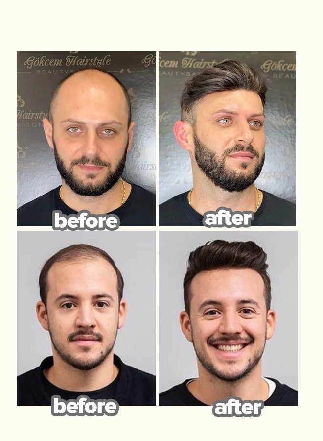 Hair Wig for Men 100% Real Human Hair Forehead wig highlights for men , V-Shape Frontal Hair Topper Soft Thin Skin Base Natural Hairline hair-and-scalp-treatments (black) - Image 2