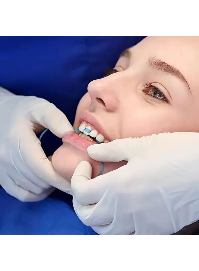 شريط تلميع الأسنان ذو وجهين أزرق ناعم متوسط الحبيبات بطول 236 بوصة لتشكيل وتنعيم الأسنان - Image 1