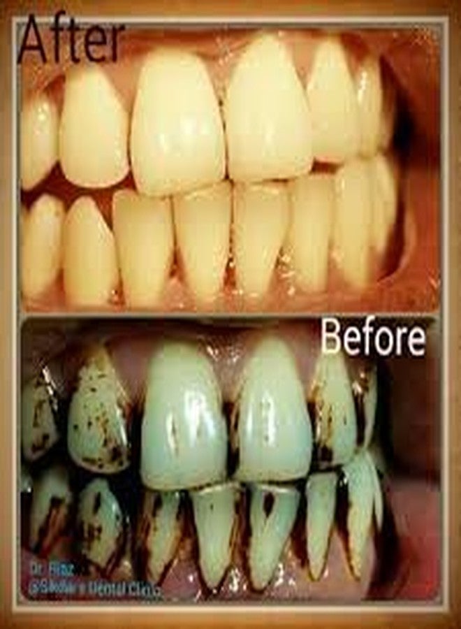 Nanni - Herbal Teeth Stain Remover | Tobacco Stain Remover | Freshens Laugh by Herbal - Image 4