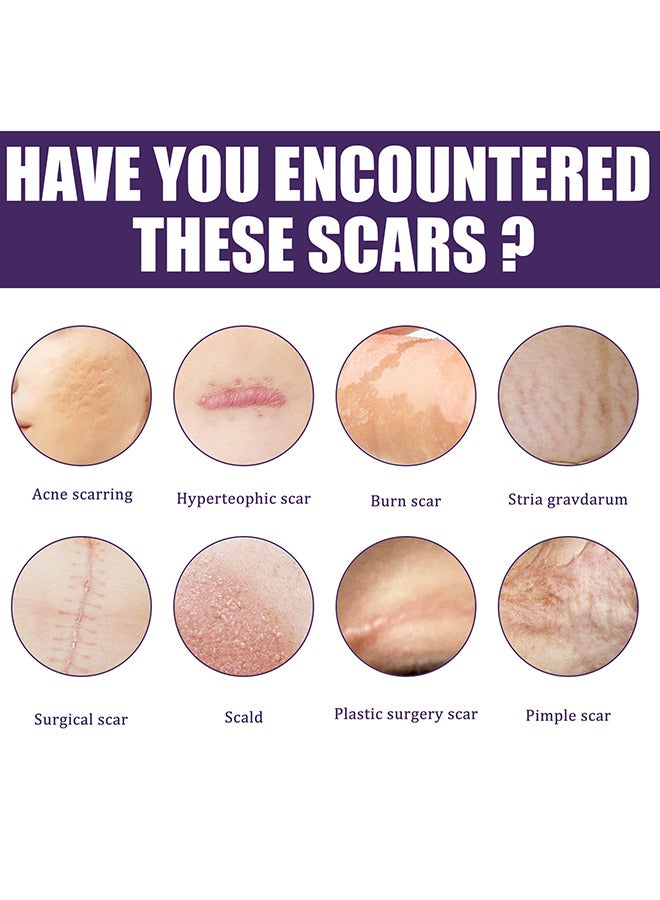 إيلهو 1 حقيبة / 8 قطعة سليكوون وشاح - Image 4