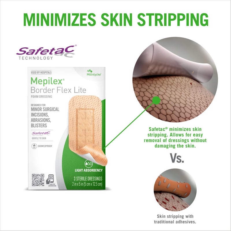 Mepilex ميبيليكس بورد فليكس لايت 2 × 5 بوصة (5 × 12.5 سم) ضمادات من الدرجة الطبية للجروح الجراحية الطفيفة، الخدوش والبثور للاستخدام لعدة أيام - Image 3