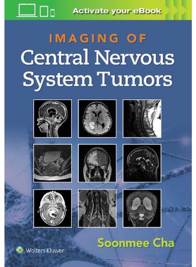 Imaging of Central Nervous System Tumors  Ed   1 