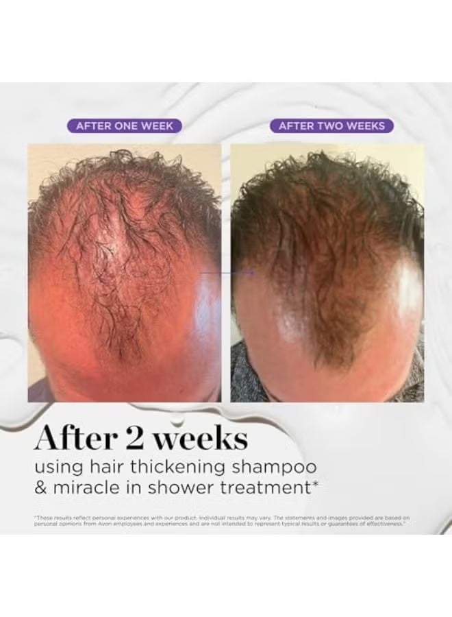 Dr.Groot Dr. Groot Hair Thickening Shampoo, Korean Hair Care with biotin, Rosemary Oil to help Volumize Thinning, Damaged Hair, Hydrate Hair and Scalp, Biotin Shampoo,Scalp Revitalizing Solution - Image 4