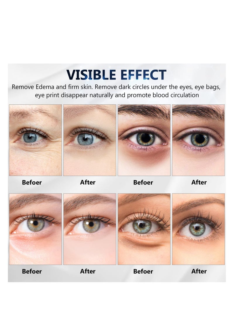 SYOSI Facial Machine, Eye Skin Tighten Massager, Home Massager for Eyes, Metal Body, Gold-plated Lead-in, Easy to Carry, Anti Aging Wrinkle and Bubble, Reducing Dark Circles, Wrinkles or Eye Bags, Eye SPA - Image 3