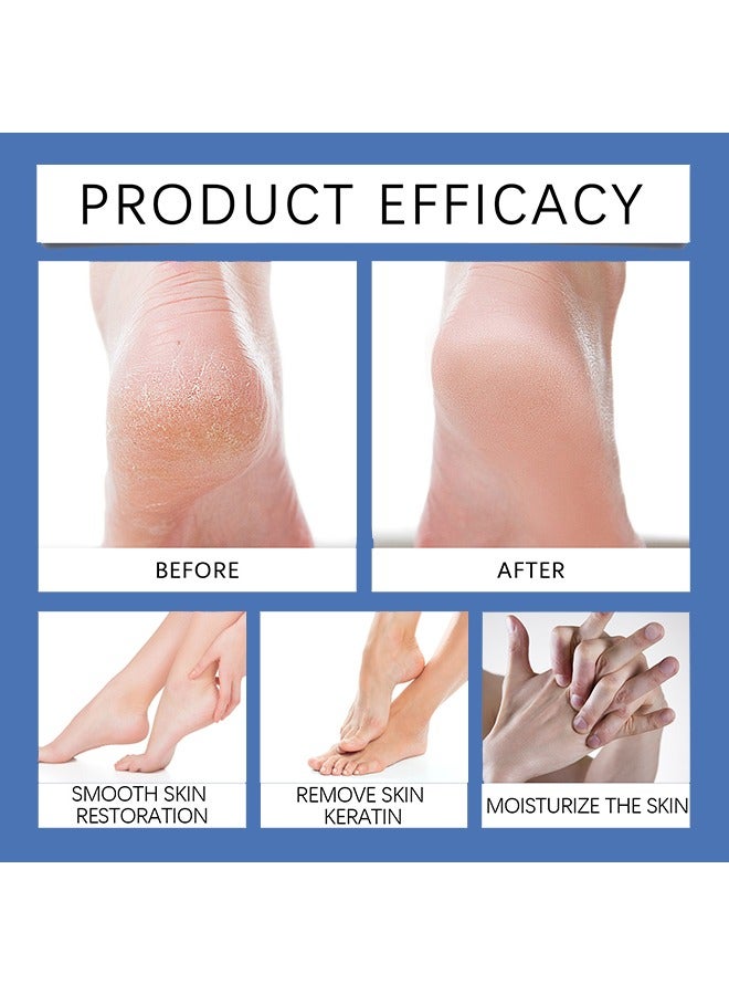 BARUBT 60% Urea Cream Plus 2% Salicylic-Acid Foot Cream - Urea Cream for Feet Moisturizer for Dry Cracked Feet Knees Elbows Hands - Heel Balm Stick Aloe Vera, Beeswax, Urea Foot Cream Smoothing Skin 40g - Image 3