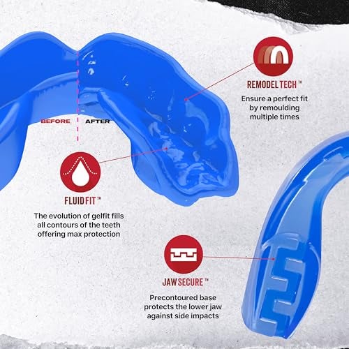 SafeJawz Elements Dual Layer Mouthguard Premium Protection Adults and Junior Gum Shield with Case for Boxing, MMA, Rugby, Martial Arts, Judo and All Contact Sports (Ice, Adult (12+)) - Image 3