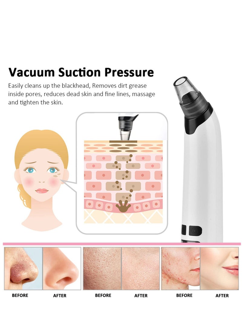 Arabest Electric Black Head Pimple Vacume Removal Tool with Hot Compress USB Rechargeable Acne Comedone Whitehead Extractor - Image 5