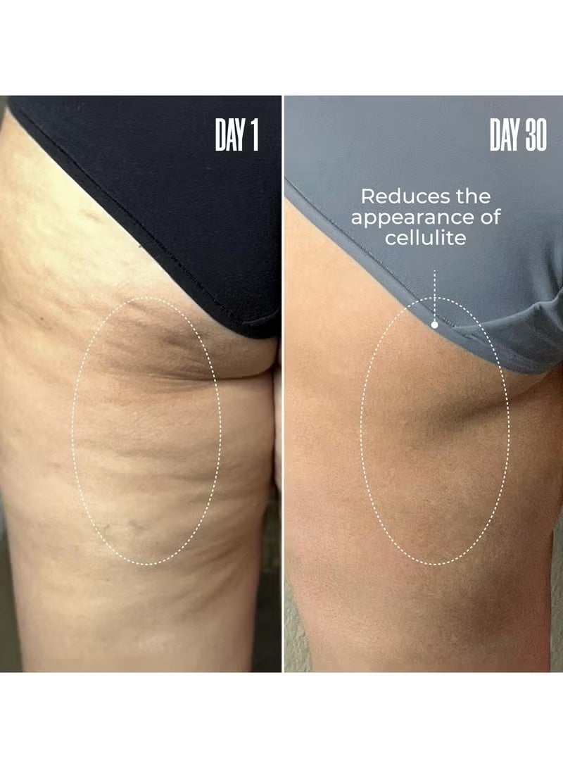 Maelys Cosmetics B-TIGHT Leave-On Cellulite Mask - Reduces The Appearance Of Cellulite - Visibly Tightens The Skin In The Butt Area - Image 5