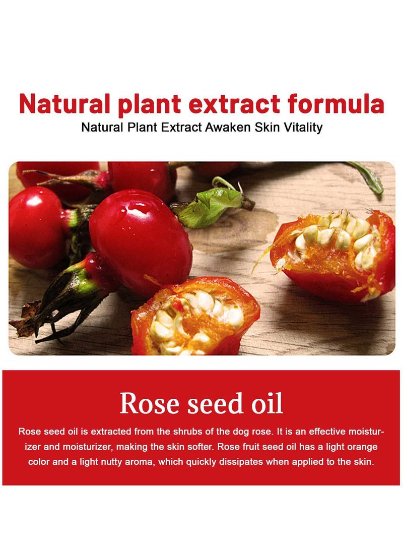 LUNOON Rosehip Oil for Face, Cold Pressed Rosehip Oil for Body, Rosehip Seed Oil for Anti-Aging, Scar Treatment, Face, Hair Relaxer & Skin Moisturizer, 1FL. OZ - Image 2