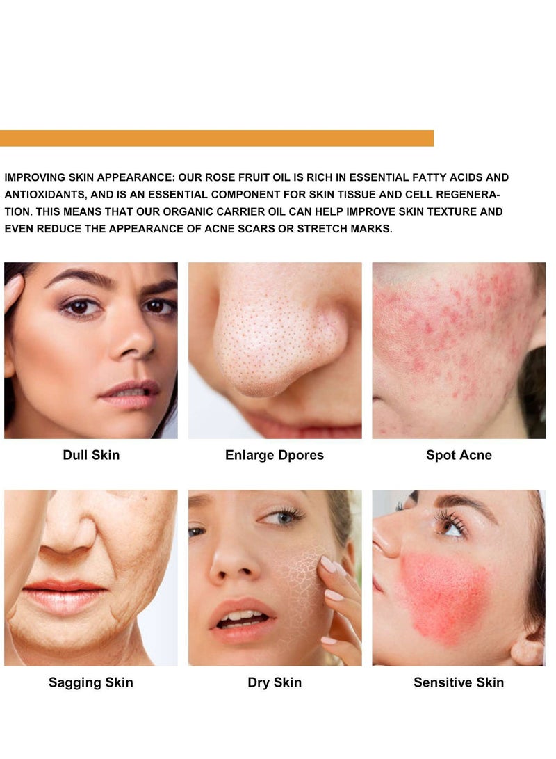 LUNOON Rosehip Oil for Face, Cold Pressed Rosehip Oil for Body, Rosehip Seed Oil for Anti-Aging, Scar Treatment, Face, Hair Relaxer & Skin Moisturizer, 1FL. OZ - Image 5