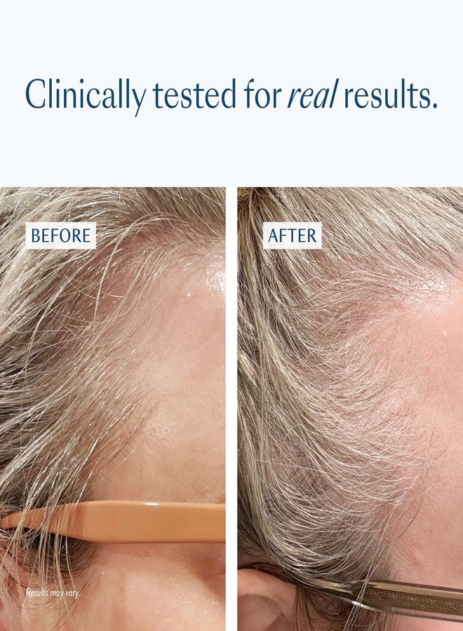eSalon Densifying Scalp Serum with Procapil and Redensyl, 58% Hair Loss Reduction, 1 fl oz - Image 4