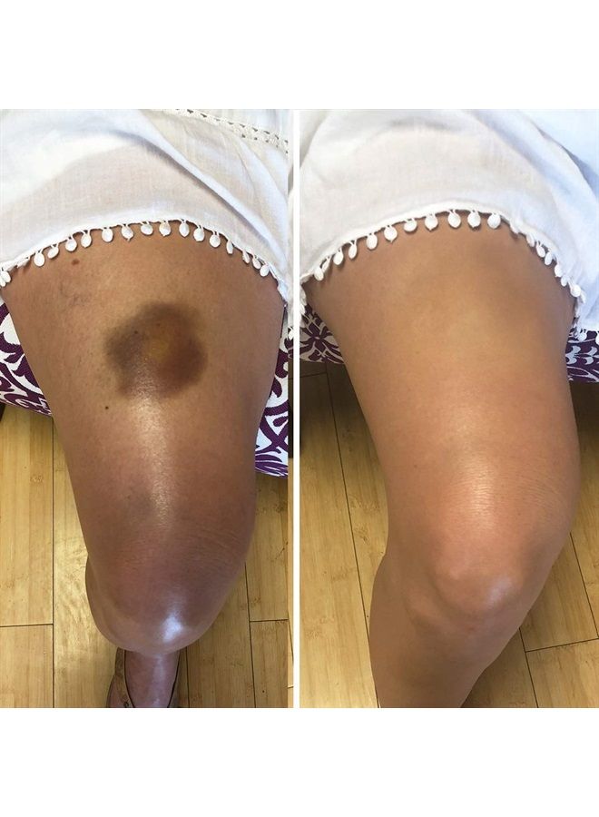 dermaflage كريم خافي العيوب المقاوم للماء - تغطية كاملة وتطابق اللون - مستخدم من قبل فناني المكياج في هوليوود - يدوم طويلاً، لمسة غير لامعة للوجه والجسم - يغطي الهالات السوداء، الوشوم، حب الشباب - Image 5