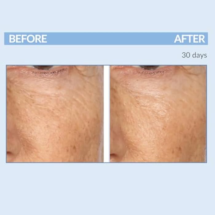 Serious Skincare Retinol Fine Lines and Wrinkles Skin Care Set - A Force XR Serum and A Cream XR Moisture Cream for Face - Anti-Aging - Minimize Post Acne Marks - Resurface and Hydrate - Serious Skincare - Image 3