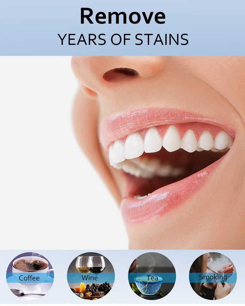 MySmile عبوة إعادة تعبئة جل تبييض الأسنان MySmile، 6 جل تبييض أسنان غير حساس لأسنان بيضاء، مزيل بقع الأسنان بدرجة طبية لعلبة، تبييض سريع بنتيجة خلال 10 دقائق - Image 3