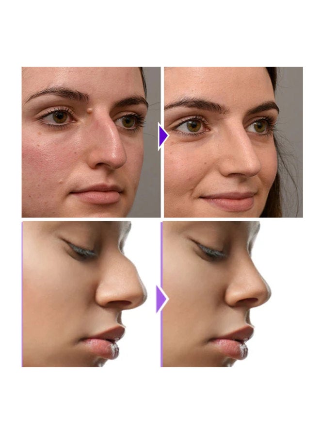 إيلهو Eelhoe مشكل الأنف مشكل الأنف كونتور مدمج شد وضيق جذر الأنف المرتفع عارضة الأنف الجميلة مشكل الأنف - Image 4