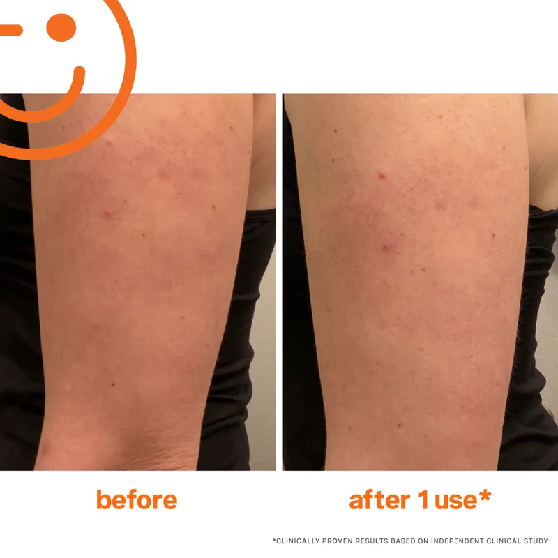 Kate Somerville ExfoliKate Resurfacing Body Scrub 150ml