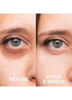Epielle Firming Eye Cream Antiaging Serum For Sagging Skin And Wrinkles With Cooling Applicator Mother'S Day Gifts Teacher Appreciation  - Image 5
