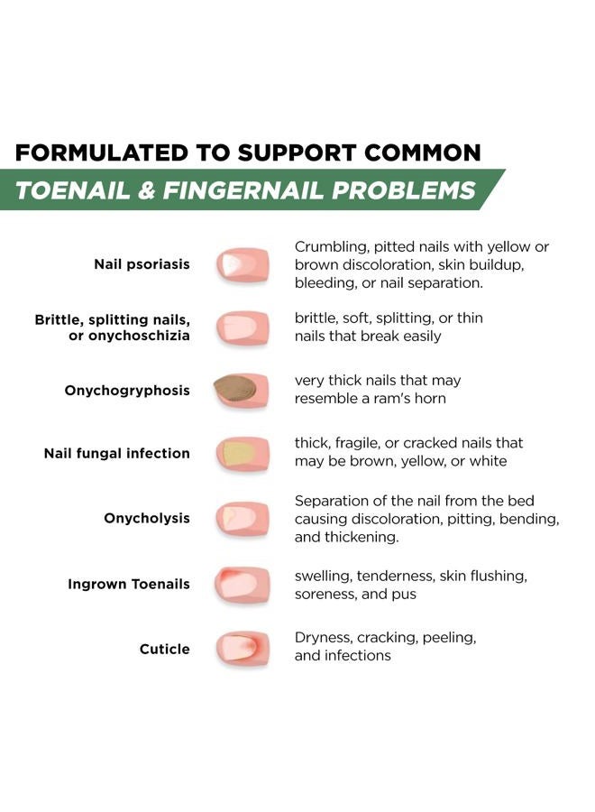 Foot Cure Toenail Fungus Treatment Extra Strength for Ingrown and Discolored Nails - Image 4