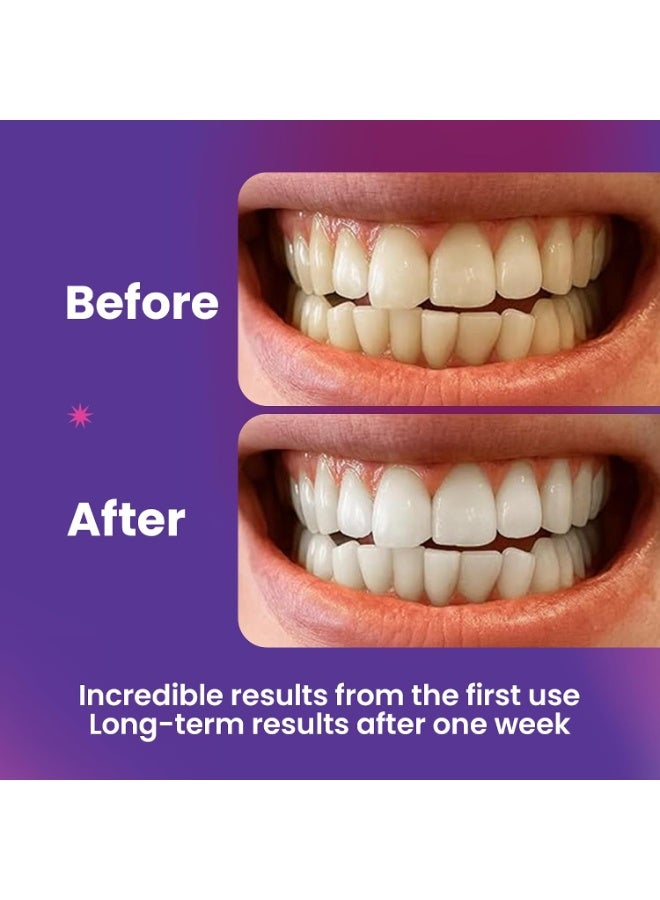 general ESMILE 28 Professional Teeth Whitening Strips Purple - Instant Result Effect V34 - Fast Teeth Whitening at Home | Ideal for Coffee Stains, Wine, Smoking | Delicate for Sensitive Teeth - Image 3
