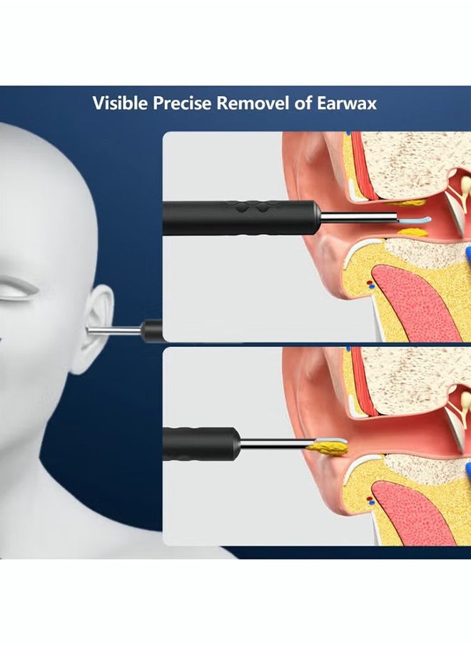 Ear Wax Removal Kit - Ear Wax Removal with Camera Wi-Fi Visible Descaling Spoon with 6 Soft Silicone Ear Spoons Wireless Ear Endoscope 30fps HD with LED Light 2.4Ghz for iPhone/iPad/Android Phone