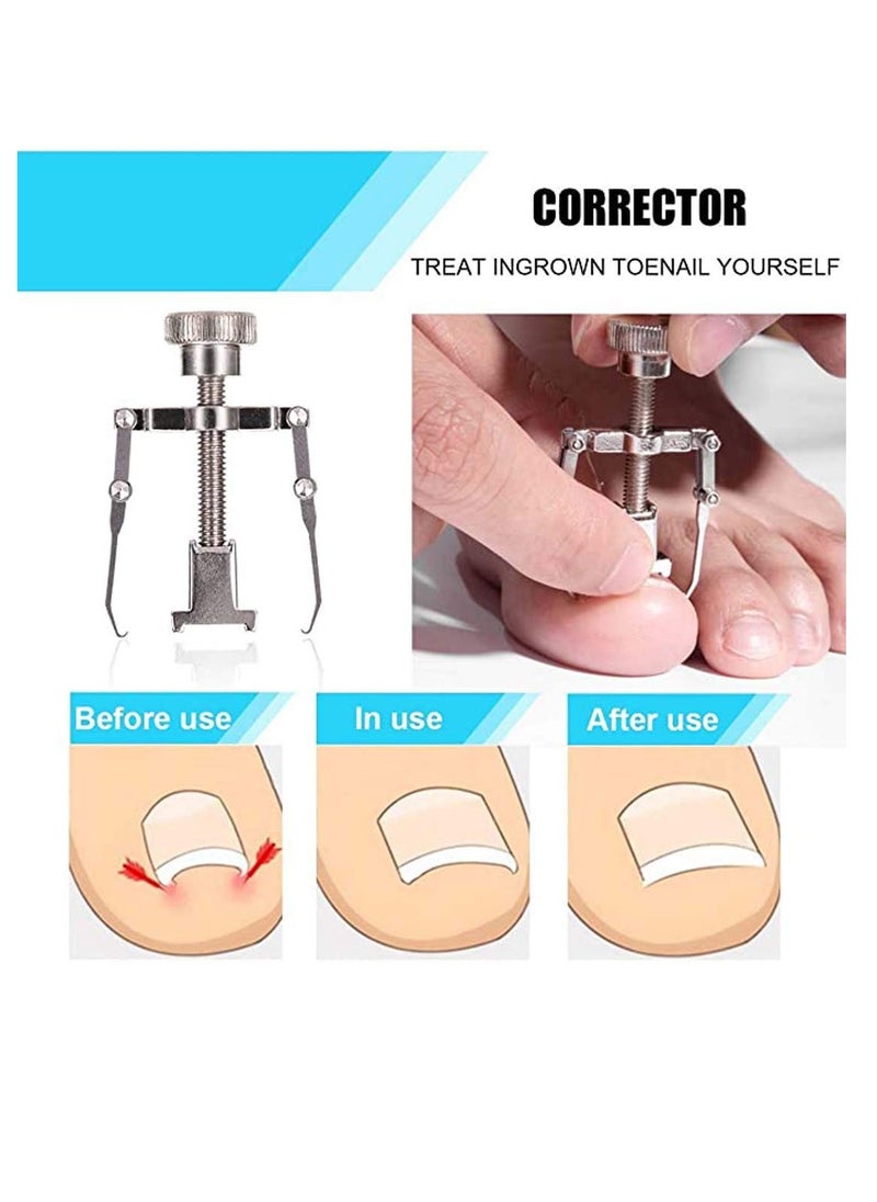 Excefore - Toenail Clippers Set 7Pcs, Staineless Steel Ingrown Toenail Tool Kit, Professional Toe Nail Nippers Set Pedicure Treatment Tool for Ingrown & Thick Nail, Surgery Grade Manicure Pedicure Tool - Image 1