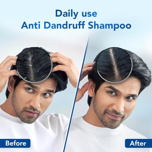 Scalpe Pro Daily Anti-Dandruff Shampoo | Removes Dandruff from Source | Prevents Itching & Irritation | Scalpe Science | Climbazole Formulation | Dermatologically Tested | For Women & Men | 400ml - Image 3