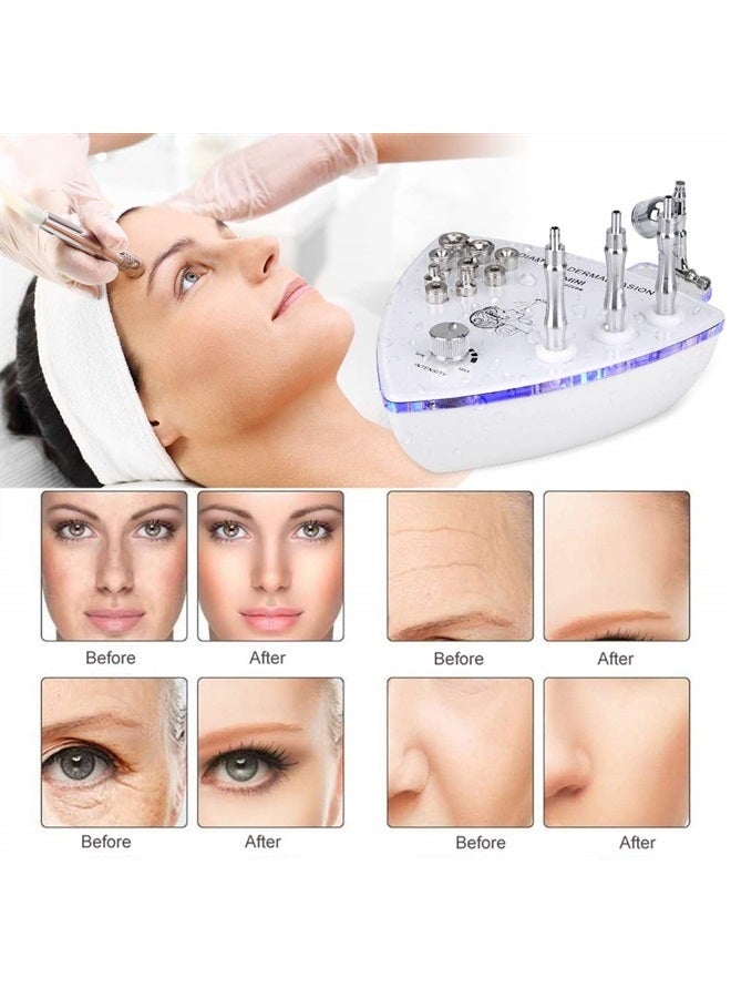 Beauty Star Microdermabrasion Machine with Spray Gun, Professional Home Use Facial Beauty Salon Equipment Strong Suction Power 65-68cmhg - Image 2
