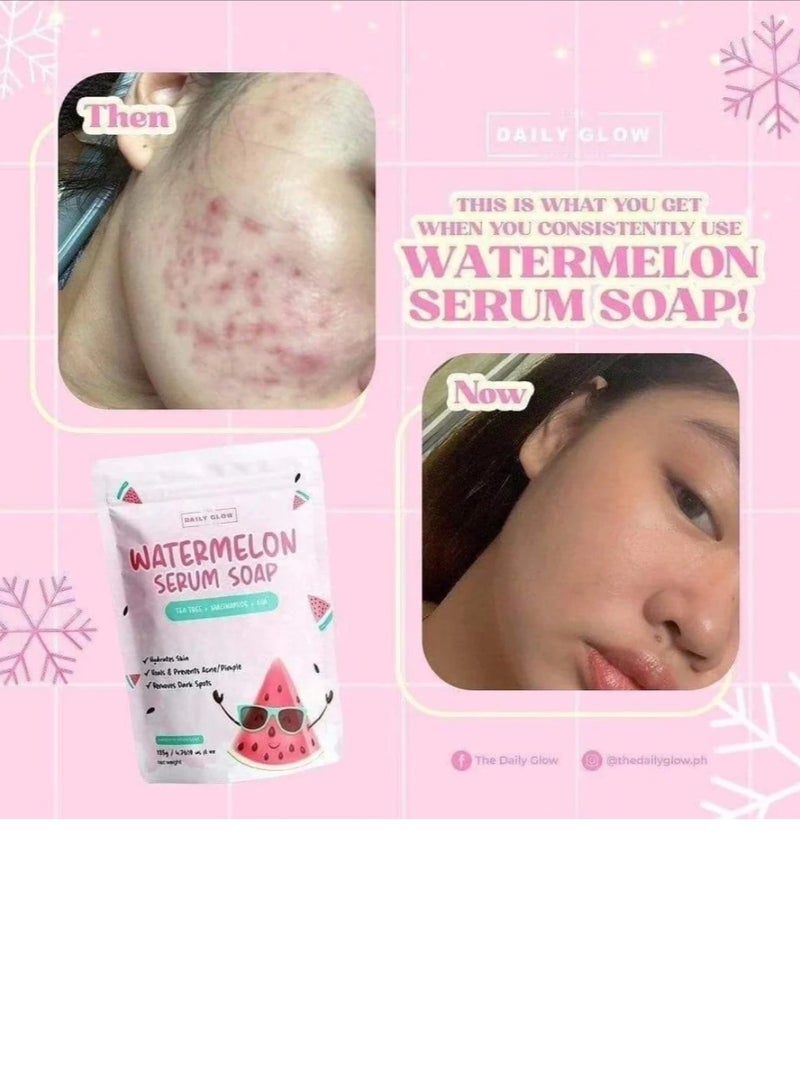 THE DAILY GLOW WATERMELON SERUM SOAP/TEA TREE+NIACINAMIDE+AHA/135G - Image 4