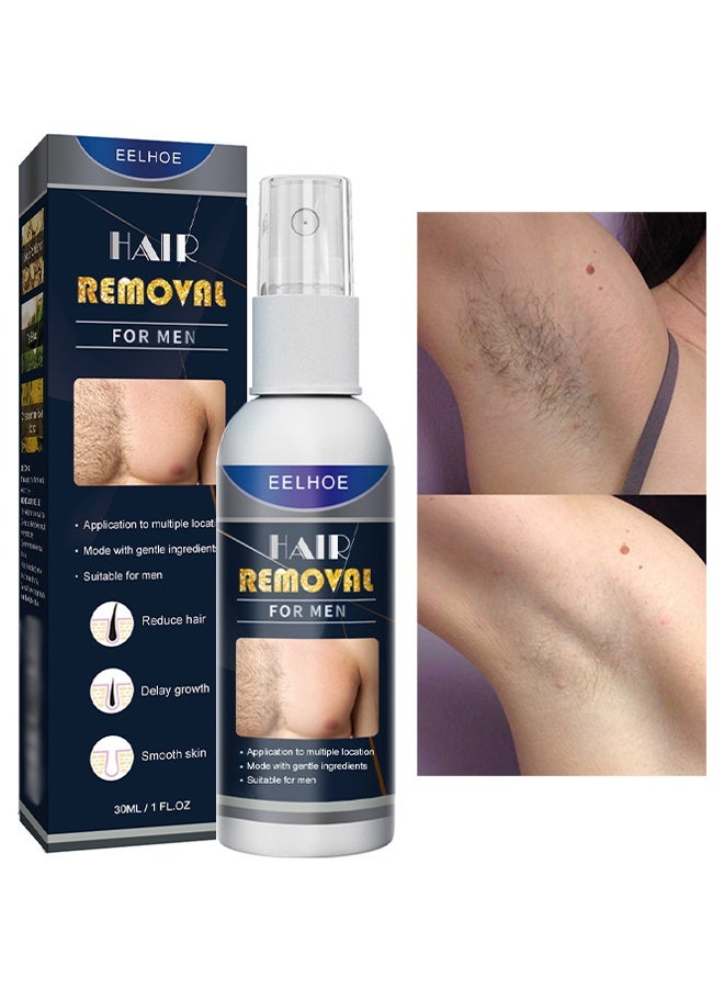 إيلهو إزالة الشعر للرجال، بخاخ لإزالة الشعر بدون ألم للابط، مزيل شعر لطيف، بخاخ تجديد سريع لإزالة الشعر، بخاخ لإزالة الشعر بمكونات طبيعية للرجال - Image 1