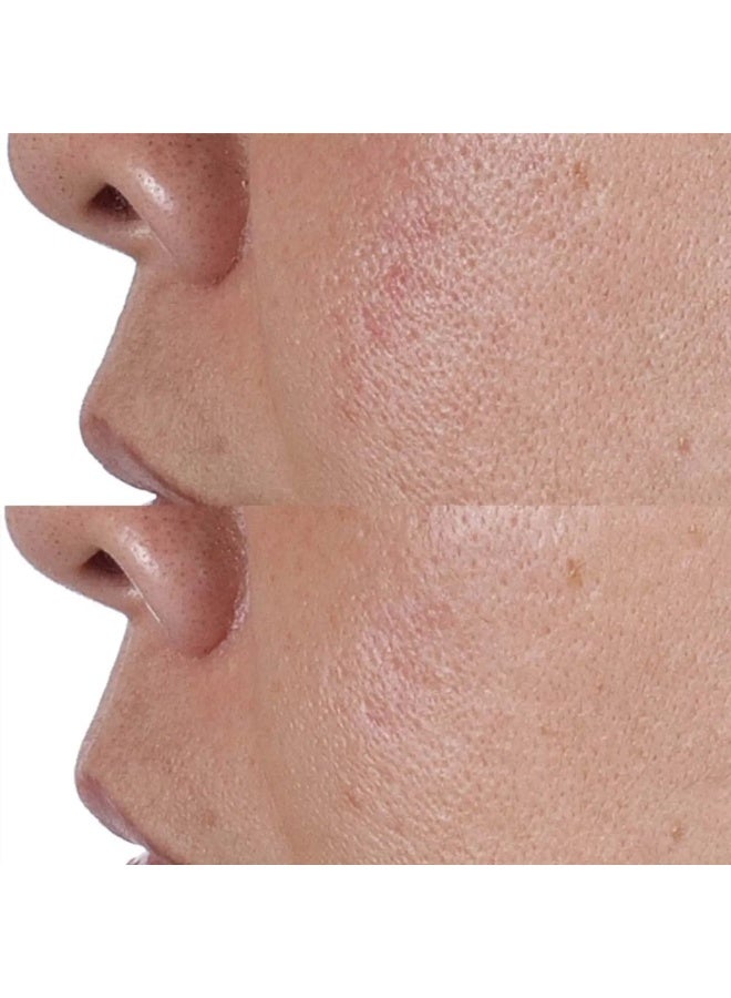 Perricone MD High Potency Face Finishing & Firming Toner - Refines Uneven Complexion 118ml - Image 3