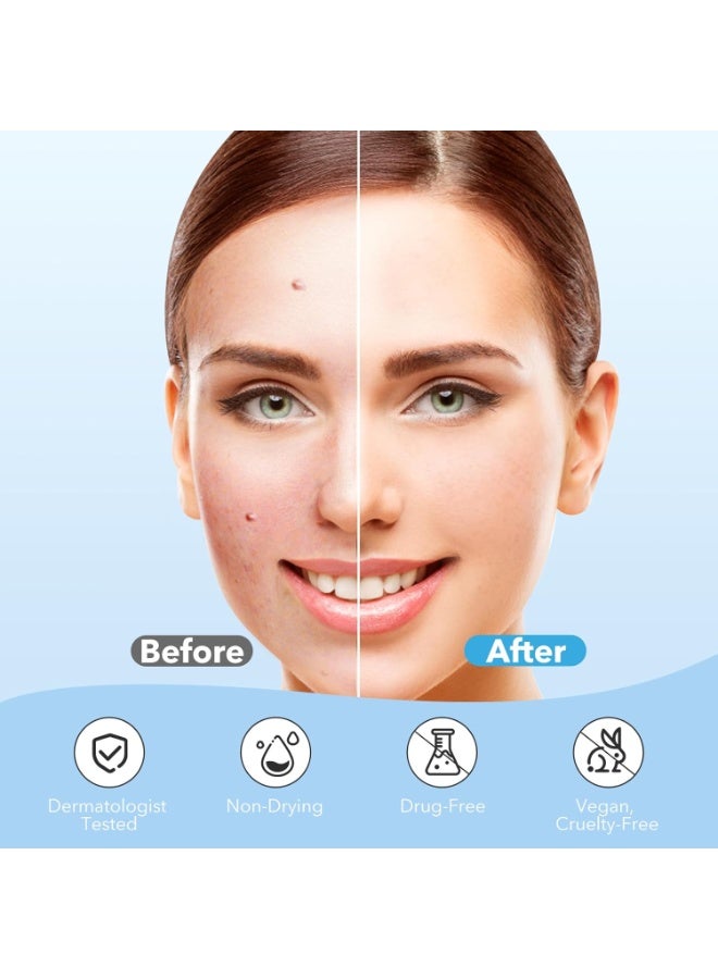 ningnatural لصقات حب الشباب، لصقات هيدروكوليد لحب الشباب لتغطية الوجه، بقع، لصقات ماصة، لصقات تجميلية لنقاط حب الشباب، علاج حب الشباب، لصقات حب الشباب غير المرئية (150 قطعة) - Image 4
