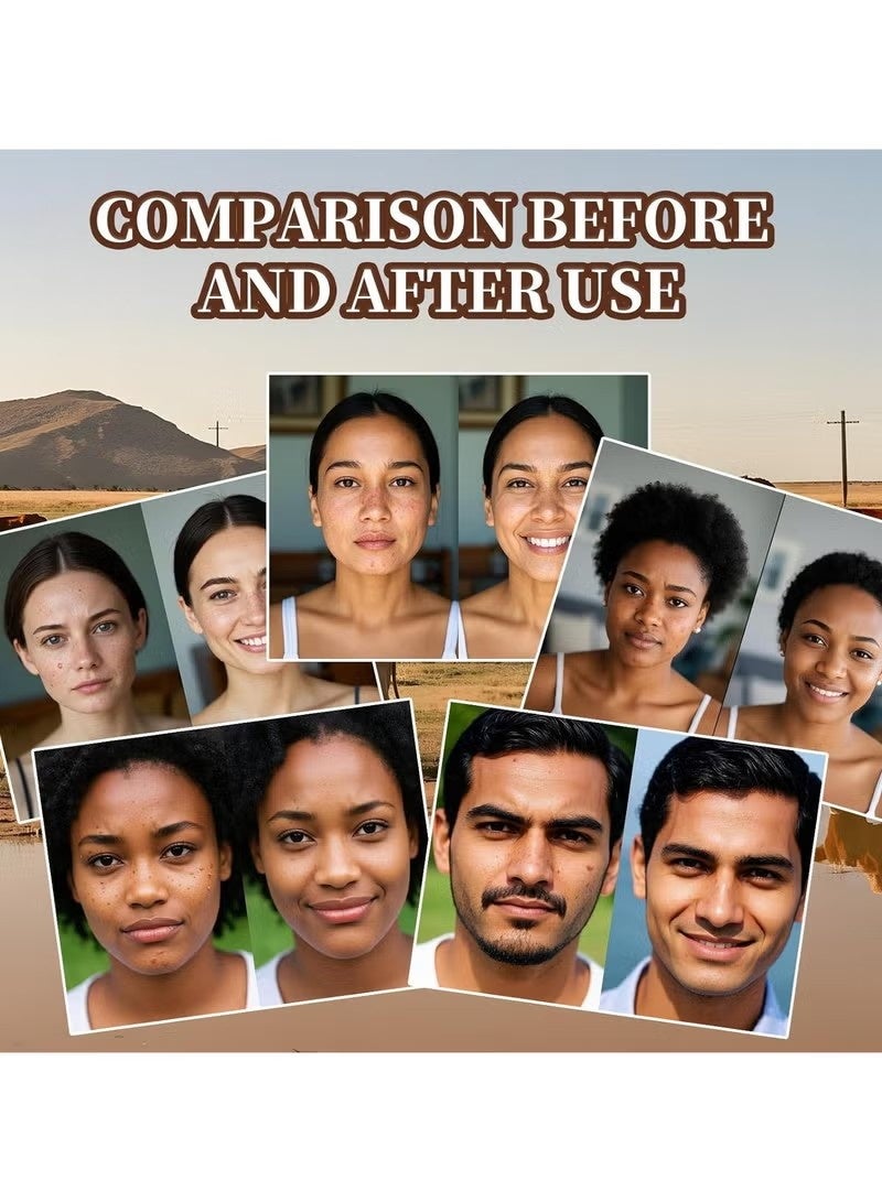 ATRJSZ Beef Tallow for Skin, Tallow and Honey Balm, Facial Moisturizer Cream, 100% Organic Grass Fed Whipped Beef Tallow Balm Deeply Moisturizing for Face & Body, Suitable For All Skin Types(3.53oz) - Image 5