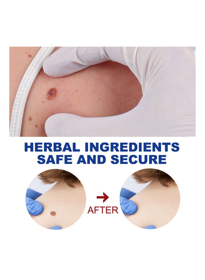 EELHOE مرهم إزالة الثآليل، ثؤلول شائع لإزالة علامات الجلد على الجسم وعلامات الجلد على الوجه - Image 4