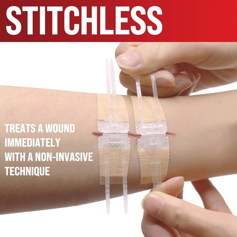 MYHELP Emergency Wound Closure Strips  2pk  Laceration Closure Kit  Stitchless  Easy to Use  Butterfly Bandages - Image 3