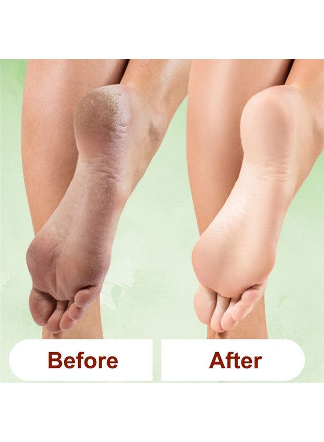 KAZARMAA Lemon Grass Foot Scrub For Home Pedicure For Removal Of Dead Skin And Moisturised Feet -100G And Foot Scrubber Tool - Image 3