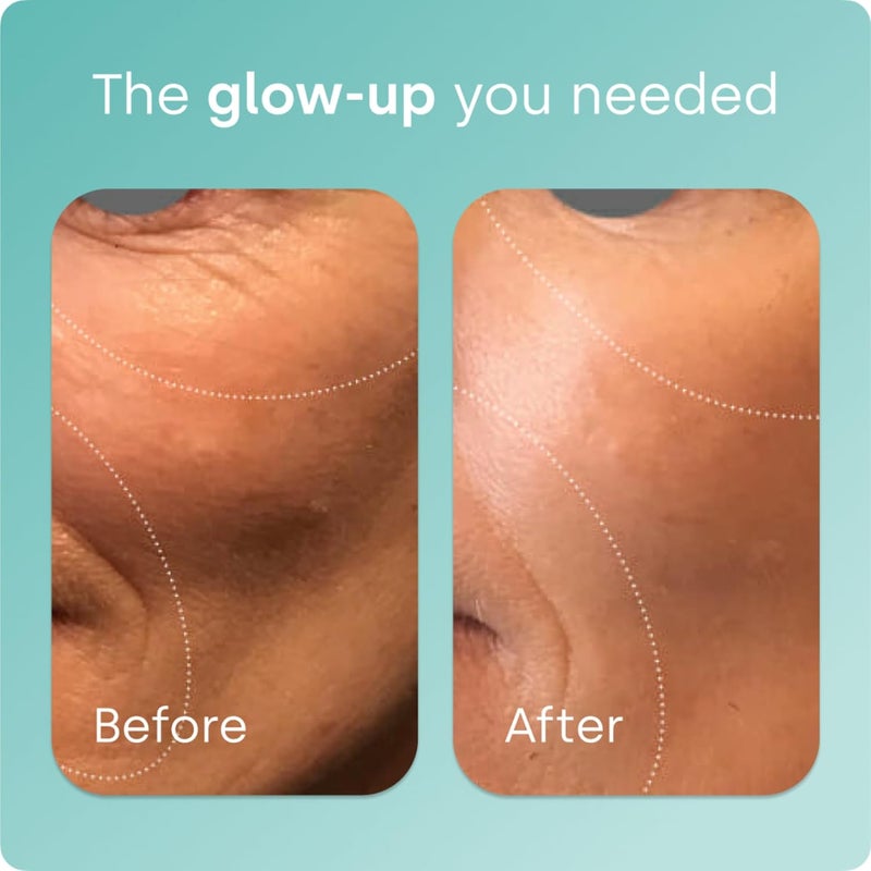 Biosil Collagen Generator - 60 Capsules - with Patented ch-OSA Complex - Generates & Protects Your Own Collagen - GMO Free - 60 Servings - Image 3