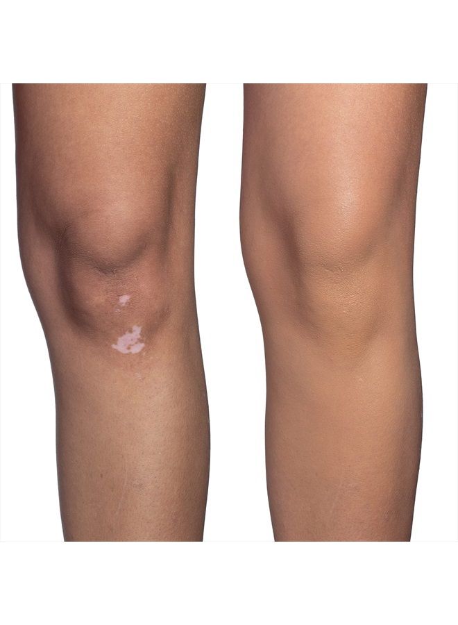 Dermablend ستيك فاونديشن كامل التغطية لمكياج الجسم سريع الإصلاح، خافي عيوب مقاوم للماء للعيوب والوشوم، 0.42 أونصة، 65W برونز: للبشرة السمراء ذات الدرجات الدافئة ولمسة من البرونز - Image 5