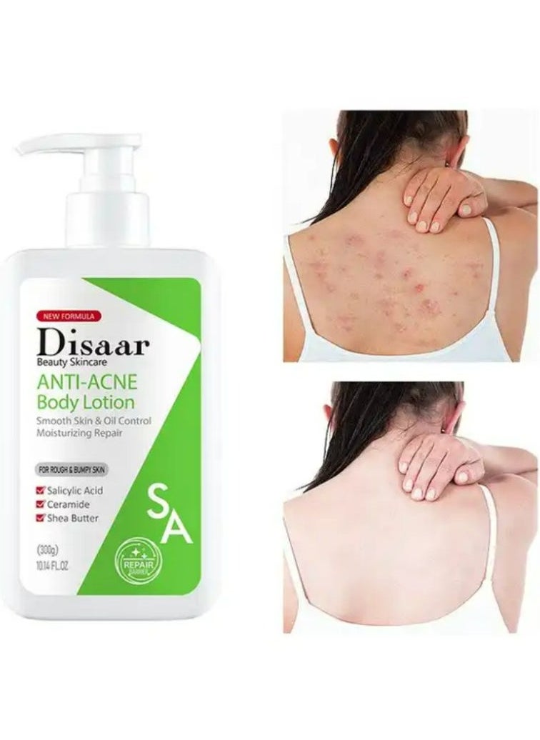 Disaar Salicylic Acid acne treatment body lotion 300 g  - Image 3