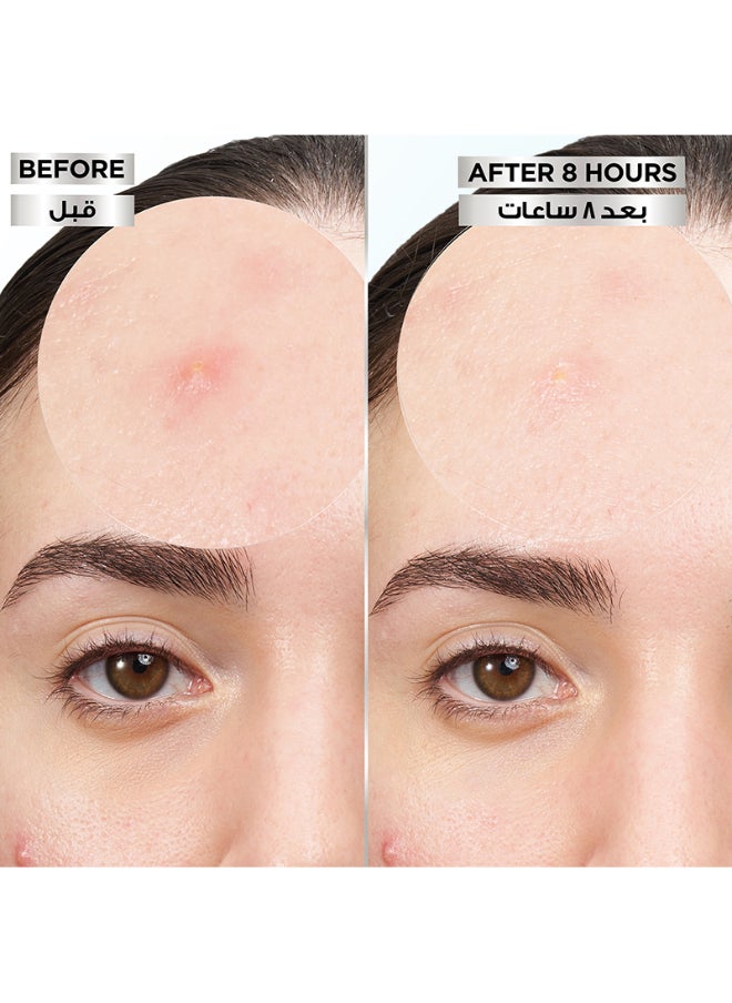 Garnier Skinactive Fast Clear 8 Hours Invisible Pimple Patch  - Image 4