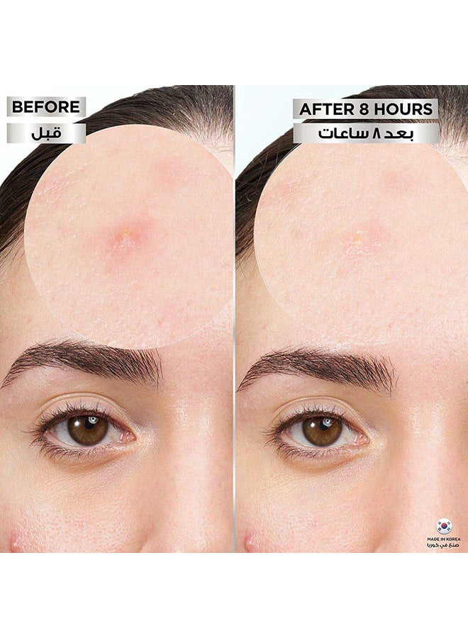 Garnier Pimple Patch Fast Clear 8 Hours Invisible - Image 5