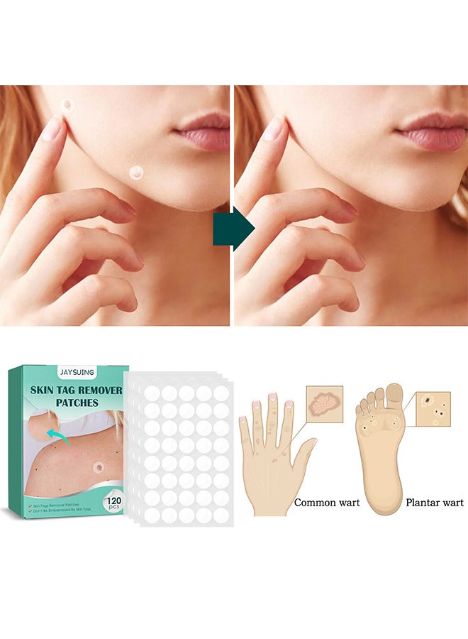Jaysuing Skin Tag Remover Patches Mole Wart Removing Sticker Natural Ingredients 120 Pieces  - Image 3