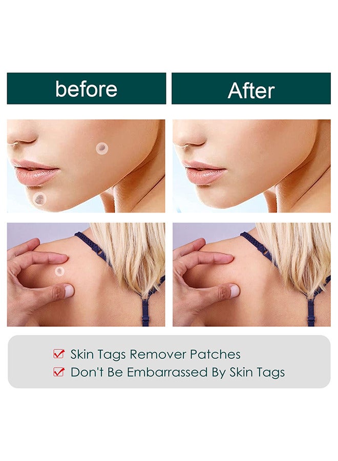 Jaysuing Skin Tag Remover Patches Mole Wart Removing Sticker Natural Ingredients 120 Pieces  - Image 4
