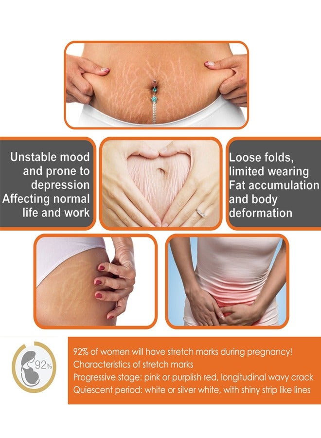 EELHOE Neuropeptide Protein With Vitamin E Massage Cream, Can Promote Cell Regeneration, Repair Necrotic Cells and Enhance Skin Elasticity, Smoothe and Soften Body Skin, Designed For Mother's Stretch Marks - Image 4