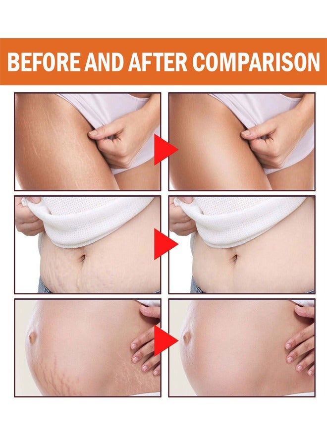 EELHOE Neuropeptide Protein With Vitamin E Massage Cream, Can Promote Cell Regeneration, Repair Necrotic Cells and Enhance Skin Elasticity, Smoothe and Soften Body Skin, Designed For Mother's Stretch Marks - Image 3