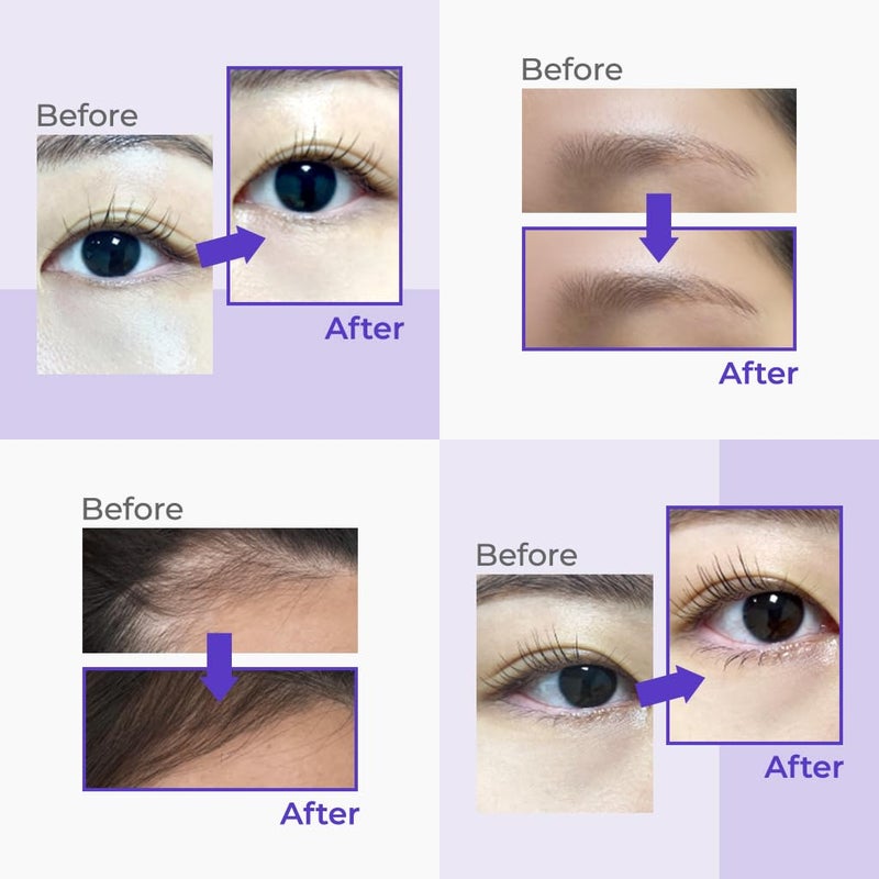 DEWYCEL سيروم تعزيز الرموش DEWYCEL مع مركب Sympeptide Nutrascalp وLacto Mushroom وCM Calming Complex لتقوية وتغذية الرموش 9 مل - Image 2