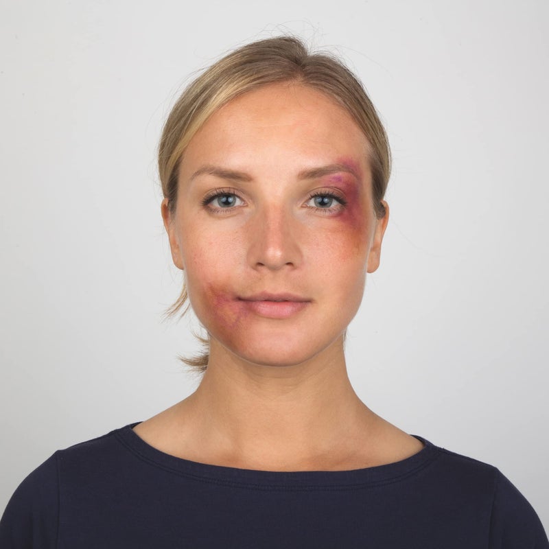 Narrative Cosmetics 6-Color Bruise Wheel, Professional SFX Cream Makeup Palette with Foam Sponges for the Stage, Film, Costumes, Cosplay - Image 4