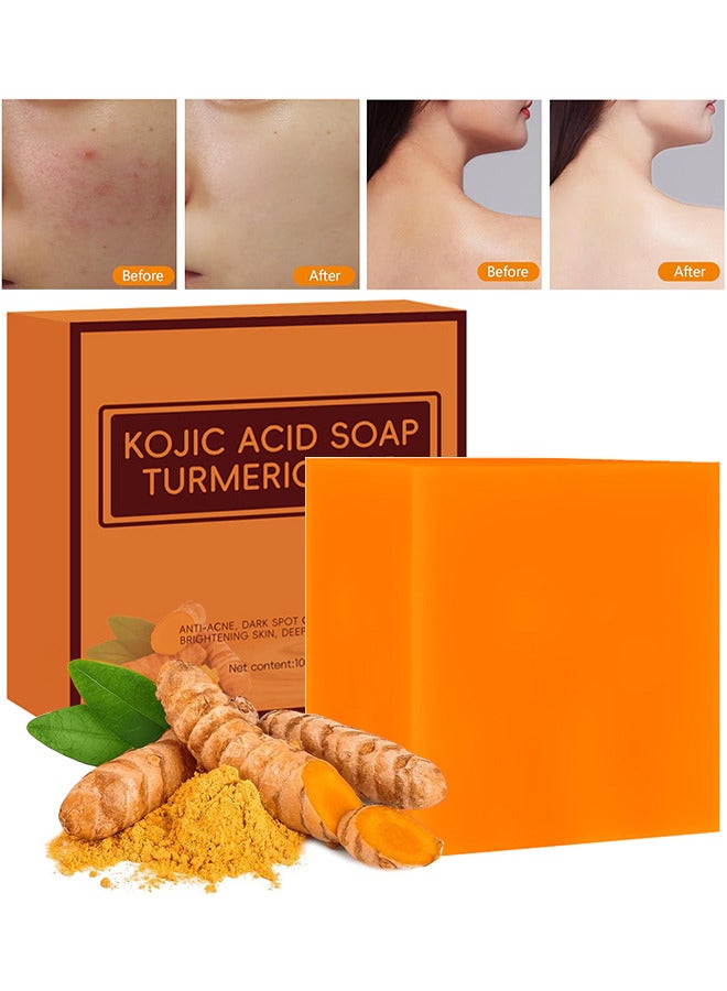 CARVENCHY Kojic Acid Soap Turmeric Bar, Anti-Acne Dark Spot Corrector Soap, Brightning Deep Cleansing Face And Body Turmeric Soap, Tretinoin Soap, Acne Facial Turmeric Kojic Acid Soap Bar - Image 1