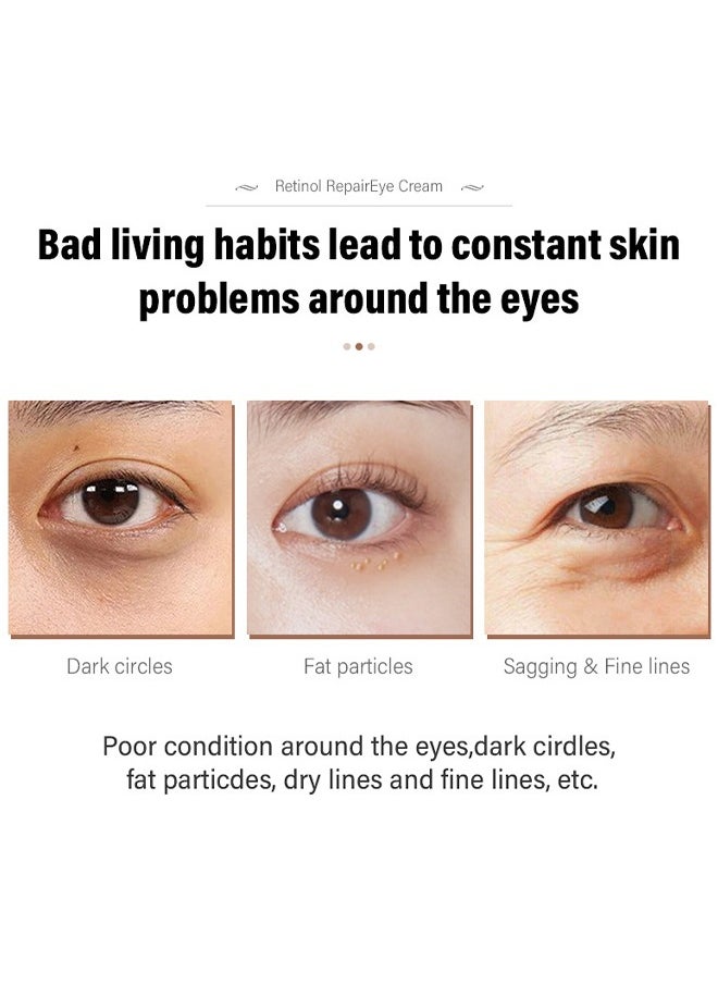 MOIKA - Retinol Repair Eye Cream, For Dark Circles And Puffiness, With AHA And BHA Dark Circle Fine Lines Treatment, Anti-Aging, Under Eye Treatment, Reduces Wrinkles, Defoams And Brightens Skin 30G - Image 1