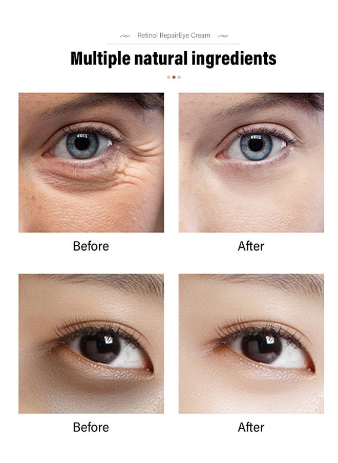 MOIKA - Retinol Repair Eye Cream, For Dark Circles And Puffiness, With AHA And BHA Dark Circle Fine Lines Treatment, Anti-Aging, Under Eye Treatment, Reduces Wrinkles, Defoams And Brightens Skin 30G - Image 1